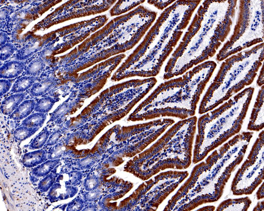 Immunohistochemical analysis of paraffin-embedded human small intestine tissue using anti-KDEL antibody. The section was pre-treated using heat mediated antigen retrieval with Tris-EDTA buffer (pH 9.0) for 20 minutes.The tissues were blocked in 1% BSA for 30 minutes at room temperature, washed with ddH2O and PBS, and then probed with the primary antibody (ET7107-86, 1/400) for 30 minutes at room temperature. The detection was performed using an HRP conjugated compact polymer system. DAB was used as the chromogen. Tissues were counterstained with hematoxylin and mounted with DPX.
