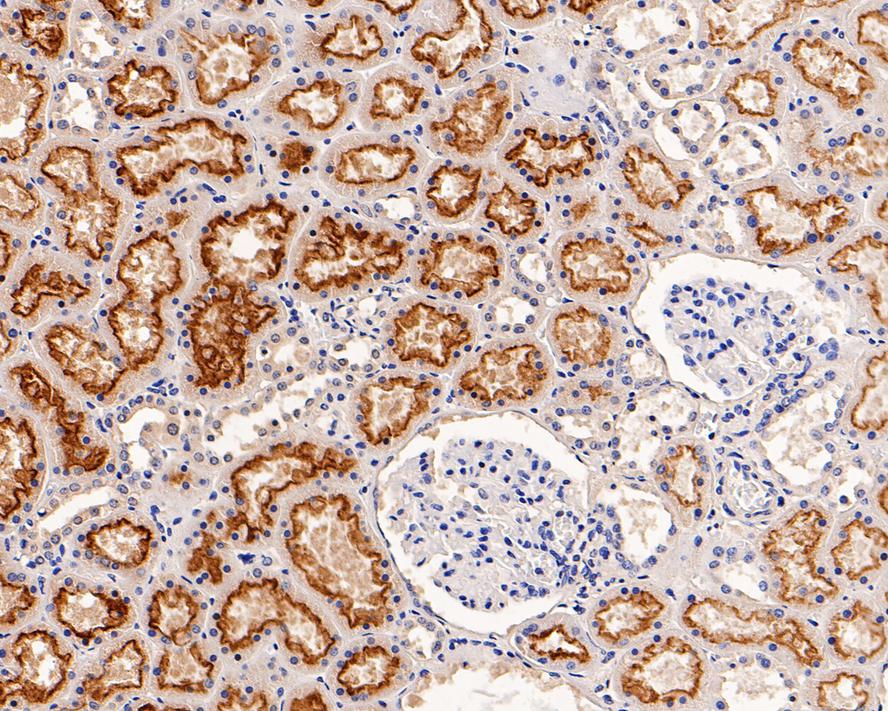 Immunohistochemical analysis of paraffin-embedded human kidney tissue using anti-Cubilin antibody. Counter stained with hematoxylin.