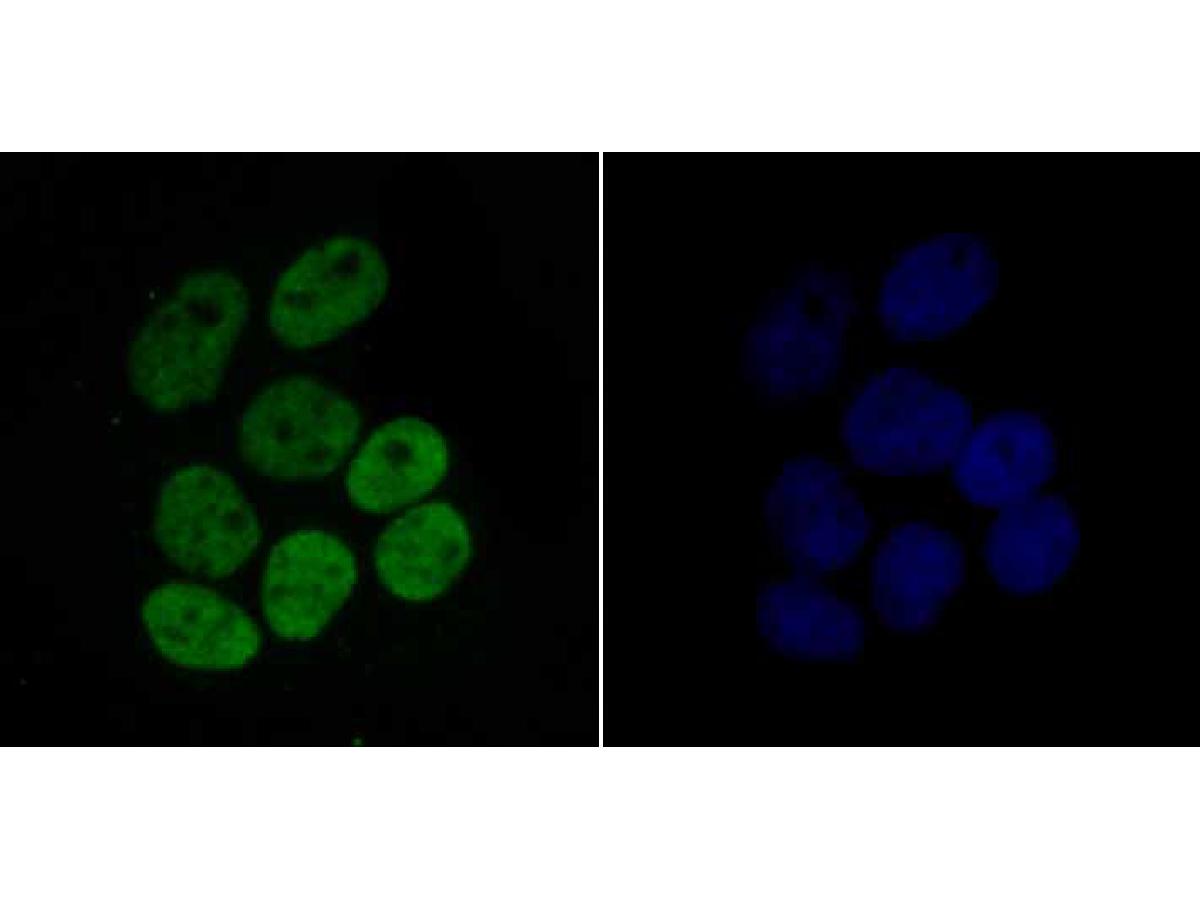 ICC staining of Histone H4 (acetyl K16) in Hela cells (green). Formalin fixed cells were permeabilized with 0.1% Triton X-100 in TBS for 10 minutes at room temperature and blocked with 1% Blocker BSA for 15 minutes at room temperature. Cells were probed with the primary antibody (ET7107-89, 1/50) for 1 hour at room temperature, washed with PBS. Alexa Fluor®488 Goat anti-Rabbit IgG was used as the secondary antibody at 1/1,000 dilution. The nuclear counter stain is DAPI (blue).