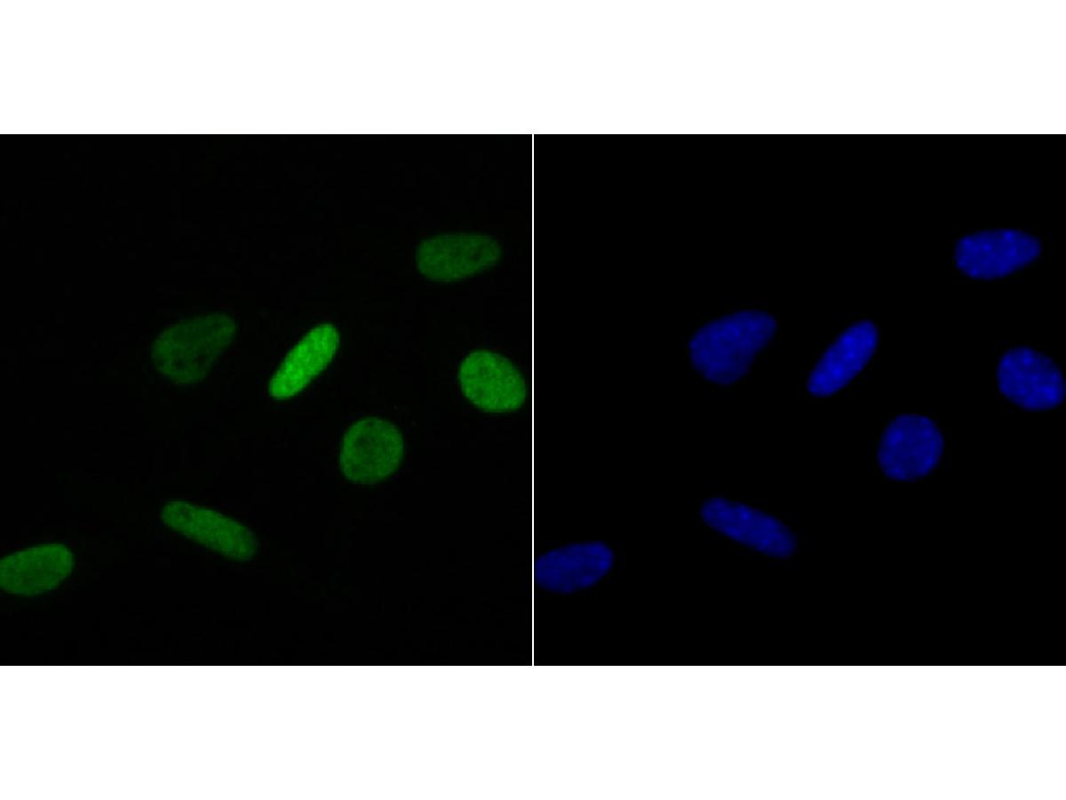 ICC staining of Histone H4 (acetyl K16) in SH-SY5Y cells (green). Formalin fixed cells were permeabilized with 0.1% Triton X-100 in TBS for 10 minutes at room temperature and blocked with 1% Blocker BSA for 15 minutes at room temperature. Cells were probed with the primary antibody (ET7107-89, 1/50) for 1 hour at room temperature, washed with PBS. Alexa Fluor®488 Goat anti-Rabbit IgG was used as the secondary antibody at 1/1,000 dilution. The nuclear counter stain is DAPI (blue).
