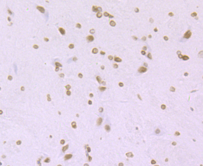 Immunohistochemical analysis of paraffin-embedded rat brain tissue using anti-Histone H4 (acetyl K16) antibody. The section was pre-treated using heat mediated antigen retrieval with Tris-EDTA buffer (pH 8.0-8.4) for 20 minutes.The tissues were blocked in 5% BSA for 30 minutes at room temperature, washed with ddH2O and PBS, and then probed with the primary antibody (ET7107-89, 1/50) for 30 minutes at room temperature. The detection was performed using an HRP conjugated compact polymer system. DAB was used as the chromogen. Tissues were counterstained with hematoxylin and mounted with DPX.