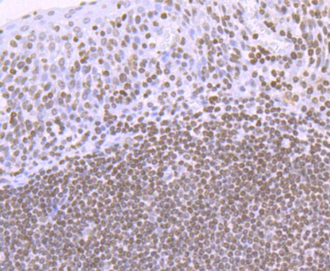 Immunohistochemical analysis of paraffin-embedded human tonsil tissue using anti-Histone H4 (acetyl K16) antibody. The section was pre-treated using heat mediated antigen retrieval with Tris-EDTA buffer (pH 8.0-8.4) for 20 minutes.The tissues were blocked in 5% BSA for 30 minutes at room temperature, washed with ddH2O and PBS, and then probed with the primary antibody (ET7107-89, 1/50) for 30 minutes at room temperature. The detection was performed using an HRP conjugated compact polymer system. DAB was used as the chromogen. Tissues were counterstained with hematoxylin and mounted with DPX.