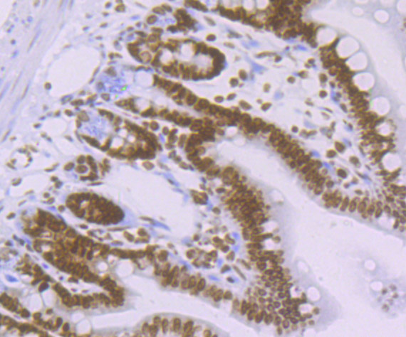 Immunohistochemical analysis of paraffin-embedded mouse colon tissue using anti-Histone H4 (acetyl K16) antibody. The section was pre-treated using heat mediated antigen retrieval with Tris-EDTA buffer (pH 8.0-8.4) for 20 minutes.The tissues were blocked in 5% BSA for 30 minutes at room temperature, washed with ddH2O and PBS, and then probed with the primary antibody (ET7107-89, 1/50) for 30 minutes at room temperature. The detection was performed using an HRP conjugated compact polymer system. DAB was used as the chromogen. Tissues were counterstained with hematoxylin and mounted with DPX.