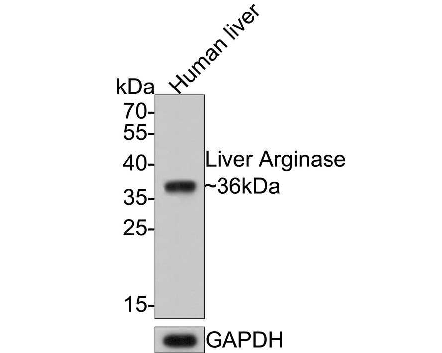 Western blot analysis of Liver Arginase on human liver tissue lysates with Rabbit anti-Liver Arginase antibody (ET7107-90) at 1/500 dilution.<br />
<br />
Lysates/proteins at 20 µg/Lane.<br />
<br />
Predicted band size: 35 kDa<br />
Observed band size: 36 kDa<br />
<br />
Exposure time: 2 minutes;<br />
<br />
12% SDS-PAGE gel.<br />
<br />
Proteins were transferred to a PVDF membrane and blocked with 5% NFDM/TBST for 1 hour at room temperature. The primary antibody (ET7107-90) at 1/500 dilution was used in 5% NFDM/TBST at room temperature for 2 hours. Goat Anti-Rabbit IgG - HRP Secondary Antibody (HA1001) at 1:200,000 dilution was used for 1 hour at room temperature.