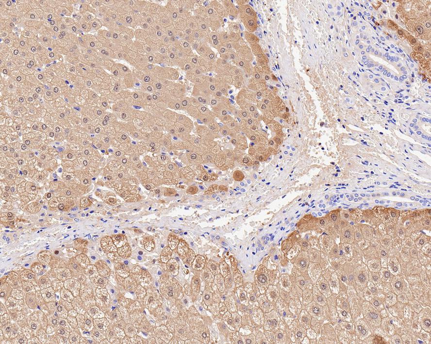 Immunohistochemical analysis of paraffin-embedded human liver tissue using anti-Liver Arginase antibody. Counter stained with hematoxylin.