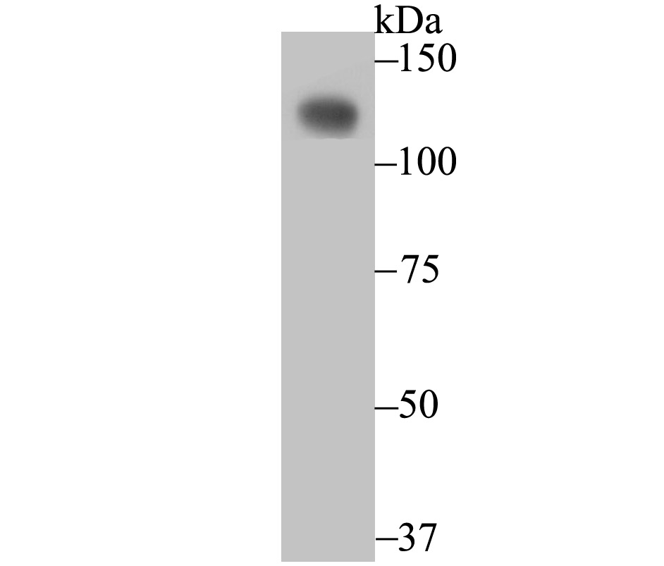 Western blot analysis of CD146 on SiHa cell lysates. Proteins were transferred to a PVDF membrane and blocked with 5% BSA in PBS for 1 hour at room temperature. The primary antibody (ET7107-91, 1/500) was used in 5% BSA at room temperature for 2 hours. Goat Anti-Rabbit IgG - HRP Secondary Antibody (HA1001) at 1:200,000 dilution was used for 1 hour at room temperature.
