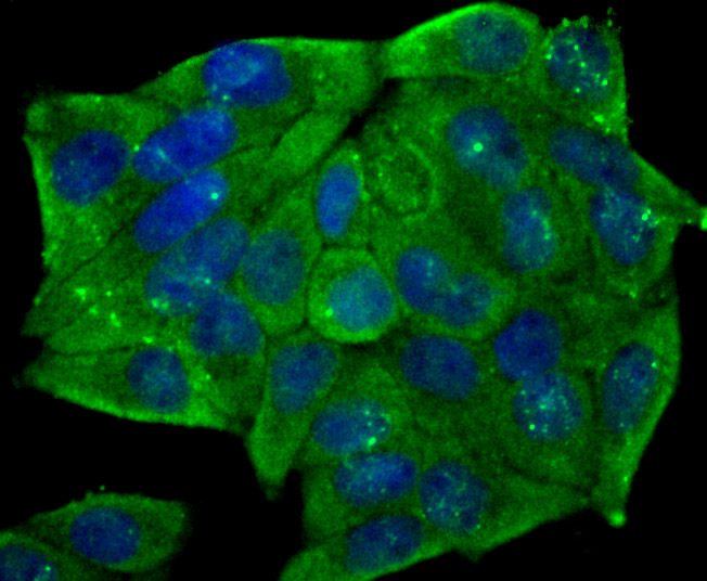 ICC staining of CD146 in Hela cells (green). Formalin fixed cells were permeabilized with 0.1% Triton X-100 in TBS for 10 minutes at room temperature and blocked with 10% negative goat serum for 15 minutes at room temperature. Cells were probed with the primary antibody (ET7107-91, 1/50) for 1 hour at room temperature, washed with PBS. Alexa Fluor®488 conjugate-Goat anti-Rabbit IgG was used as the secondary antibody at 1/1,000 dilution. The nuclear counter stain is DAPI (blue).
