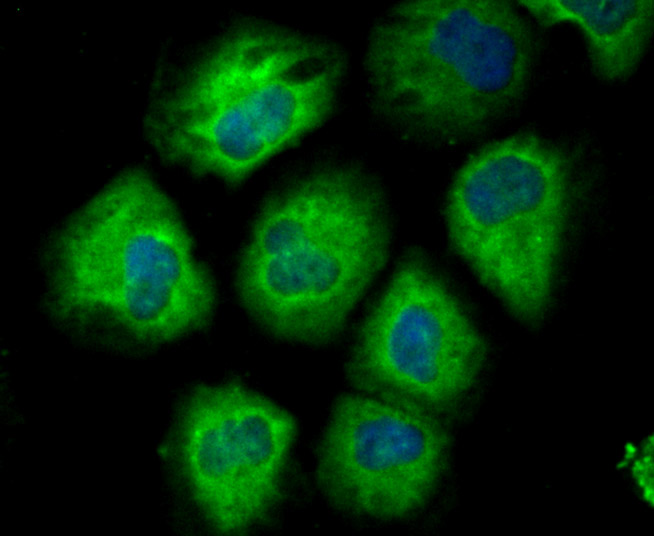 ICC staining of CD146 in HUVEC cells (green). Formalin fixed cells were permeabilized with 0.1% Triton X-100 in TBS for 10 minutes at room temperature and blocked with 10% negative goat serum for 15 minutes at room temperature. Cells were probed with the primary antibody (ET7107-91, 1/50) for 1 hour at room temperature, washed with PBS. Alexa Fluor®488 conjugate-Goat anti-Rabbit IgG was used as the secondary antibody at 1/1,000 dilution. The nuclear counter stain is DAPI (blue).