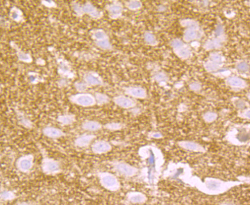 Immunohistochemical analysis of paraffin-embedded rat brain tissue using anti-CD146 antibody. The section was pre-treated using heat mediated antigen retrieval with Tris-EDTA buffer (pH 9.0) for 20 minutes.The tissues were blocked in 1% BSA for 30 minutes at room temperature, washed with ddH2O and PBS, and then probed with the primary antibody (ET7107-91, 1/50) for 30 minutes at room temperature. The detection was performed using an HRP conjugated compact polymer system. DAB was used as the chromogen. Tissues were counterstained with hematoxylin and mounted with DPX.