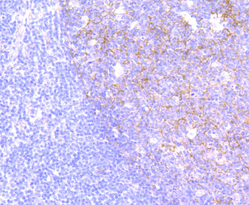 Immunohistochemical analysis of paraffin-embedded human tonsil tissue using anti-CD146 antibody. The section was pre-treated using heat mediated antigen retrieval with Tris-EDTA buffer (pH 9.0) for 20 minutes.The tissues were blocked in 1% BSA for 30 minutes at room temperature, washed with ddH2O and PBS, and then probed with the primary antibody (ET7107-91, 1/50) for 30 minutes at room temperature. The detection was performed using an HRP conjugated compact polymer system. DAB was used as the chromogen. Tissues were counterstained with hematoxylin and mounted with DPX.