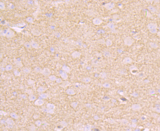 Immunohistochemical analysis of paraffin-embedded mouse brain tissue using anti-CD146 antibody. The section was pre-treated using heat mediated antigen retrieval with Tris-EDTA buffer (pH 9.0) for 20 minutes.The tissues were blocked in 1% BSA for 30 minutes at room temperature, washed with ddH2O and PBS, and then probed with the primary antibody (ET7107-91, 1/50) for 30 minutes at room temperature. The detection was performed using an HRP conjugated compact polymer system. DAB was used as the chromogen. Tissues were counterstained with hematoxylin and mounted with DPX.