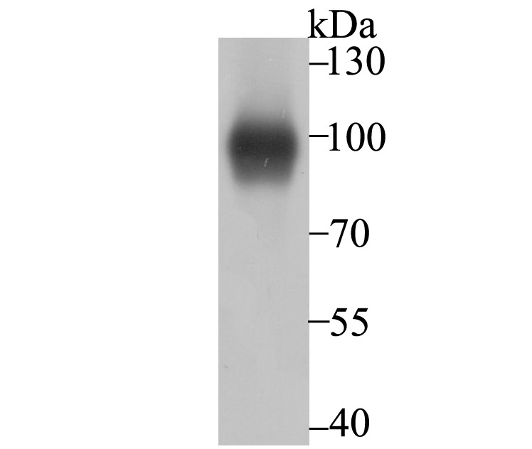 Western blot analysis of Thrombomodulin on A431 cell using anti-Thrombomodulin antibody at 1/500 dilution.