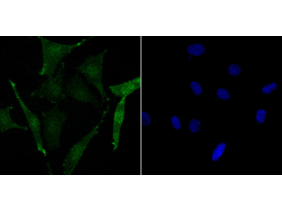 ICC staining of Phospho-Creb (S133) in SH-SY5Y cells (green). Formalin fixed cells were permeabilized with 0.1% Triton X-100 in TBS for 10 minutes at room temperature and blocked with 1% Blocker BSA for 15 minutes at room temperature. Cells were probed with the primary antibody (ET7107-93, 1/50) for 1 hour at room temperature, washed with PBS. Alexa Fluor®488 Goat anti-Rabbit IgG was used as the secondary antibody at 1/1,000 dilution. The nuclear counter stain is DAPI (blue).