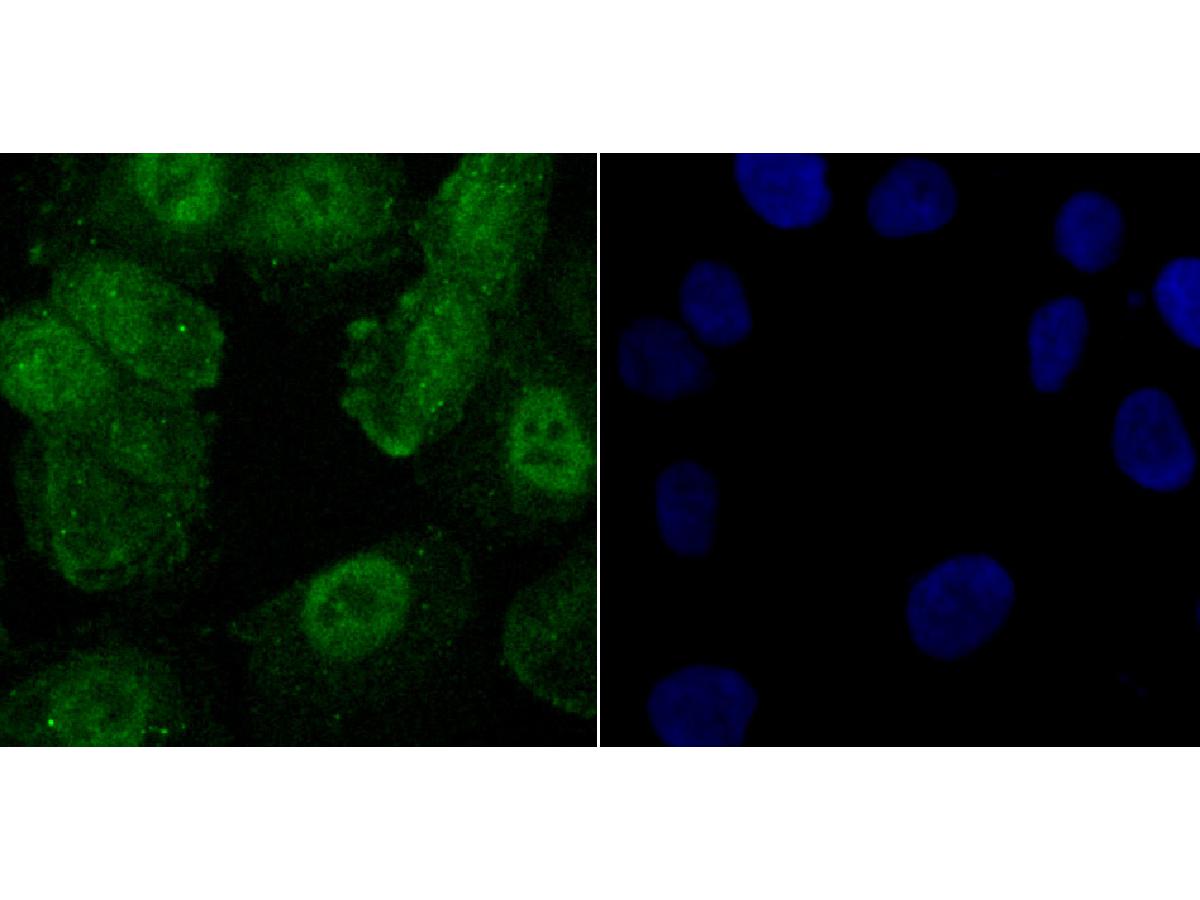 ICC staining of Phospho-Creb (S133) in SH-SY5Y cells (green). Formalin fixed cells were permeabilized with 0.1% Triton X-100 in TBS for 10 minutes at room temperature and blocked with 1% Blocker BSA for 15 minutes at room temperature. Cells were probed with the primary antibody (ET7107-93, 1/50) for 1 hour at room temperature, washed with PBS. Alexa Fluor®488 Goat anti-Rabbit IgG was used as the secondary antibody at 1/1,000 dilution. The nuclear counter stain is DAPI (blue).