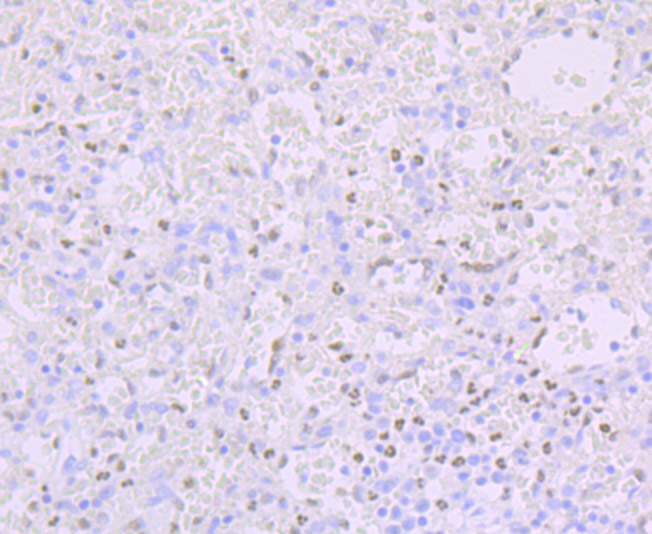Immunohistochemical analysis of paraffin-embedded human spleen tissue using anti-Phospho-Creb (S133) antibody. The section was pre-treated using heat mediated antigen retrieval with Tris-EDTA buffer (pH 8.0-8.4) for 20 minutes.The tissues were blocked in 5% BSA for 30 minutes at room temperature, washed with ddH2O and PBS, and then probed with the primary antibody (ET7107-93, 1/50) for 30 minutes at room temperature. The detection was performed using an HRP conjugated compact polymer system. DAB was used as the chromogen. Tissues were counterstained with hematoxylin and mounted with DPX.