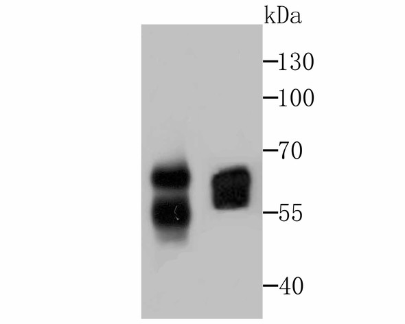 Western blot analysis of CD46 on different lysates. Proteins were transferred to a PVDF membrane and blocked with 5% BSA in PBS for 1 hour at room temperature. The primary antibody (ET7107-94, 1/500) was used in 5% BSA at room temperature for 2 hours. Goat Anti-Rabbit IgG - HRP Secondary Antibody (HA1001) at 1:200,000 dilution was used for 1 hour at room temperature.<br />
Positive control: <br />
Lane 1: SiHa cell lysate<br />
Lane 2: PC-3M cell lysate