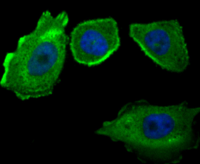 ICC staining of CD46 in PC-3M cells (green). Formalin fixed cells were permeabilized with 0.1% Triton X-100 in TBS for 10 minutes at room temperature and blocked with 10% negative goat serum for 15 minutes at room temperature. Cells were probed with the primary antibody (ET7107-94, 1/50) for 1 hour at room temperature, washed with PBS. Alexa Fluor®488 conjugate-Goat anti-Rabbit IgG was used as the secondary antibody at 1/1,000 dilution. The nuclear counter stain is DAPI (blue).