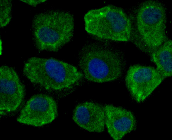ICC staining of CD46 in HUVEC cells (green). Formalin fixed cells were permeabilized with 0.1% Triton X-100 in TBS for 10 minutes at room temperature and blocked with 10% negative goat serum for 15 minutes at room temperature. Cells were probed with the primary antibody (ET7107-94, 1/50) for 1 hour at room temperature, washed with PBS. Alexa Fluor®488 conjugate-Goat anti-Rabbit IgG was used as the secondary antibody at 1/1,000 dilution. The nuclear counter stain is DAPI (blue).
