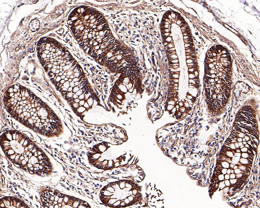 Immunohistochemical analysis of paraffin-embedded human colon tissue with Rabbit anti-CD46 antibody (ET7107-94) at 1/800 dilution.<br />
<br />
The section was pre-treated using heat mediated antigen retrieval with Tris-EDTA buffer (pH 9.0) for 20 minutes. The tissues were blocked in 1% BSA for 20 minutes at room temperature, washed with ddH2O and PBS, and then probed with the primary antibody (ET7107-94) at 1/800 dilution for 1 hour at room temperature. The detection was performed using an HRP conjugated compact polymer system. DAB was used as the chromogen. Tissues were counterstained with hematoxylin and mounted with DPX.