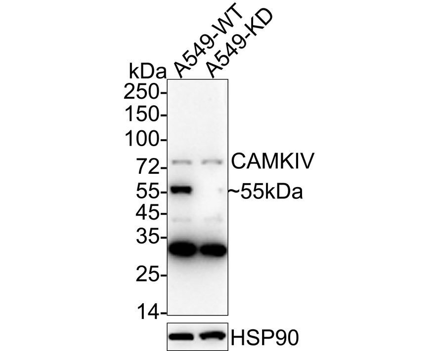 Western blot analysis of CAMKIV on different lysates. Proteins were transferred to a PVDF membrane and blocked with 5% BSA in PBS for 1 hour at room temperature. The primary antibody (ET7107-96, 1/500) was used in 5% BSA at room temperature for 2 hours. Goat Anti-Rabbit IgG - HRP Secondary Antibody (HA1001) at 1:5,000 dilution was used for 1 hour at room temperature.<br />
Positive control: <br />
Lane 1: Mouse brain tissue lysate<br />
Lane 2: Rat brain tissue lysate