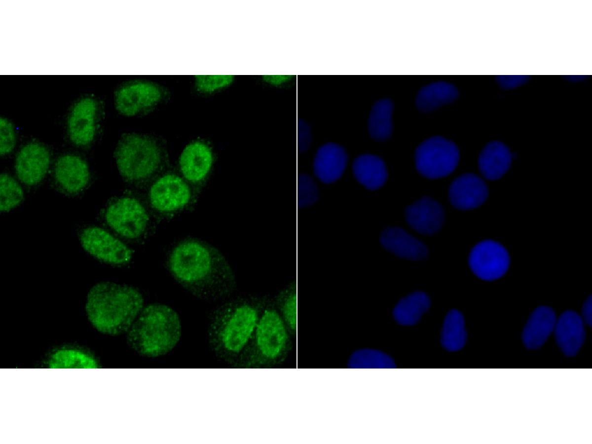 ICC staining of CAMKIV in SH-SY5Y cells (green). Formalin fixed cells were permeabilized with 0.1% Triton X-100 in TBS for 10 minutes at room temperature and blocked with 1% Blocker BSA for 15 minutes at room temperature. Cells were probed with the primary antibody (ET7107-96, 1/50) for 1 hour at room temperature, washed with PBS. Alexa Fluor®488 Goat anti-Rabbit IgG was used as the secondary antibody at 1/1,000 dilution. The nuclear counter stain is DAPI (blue).