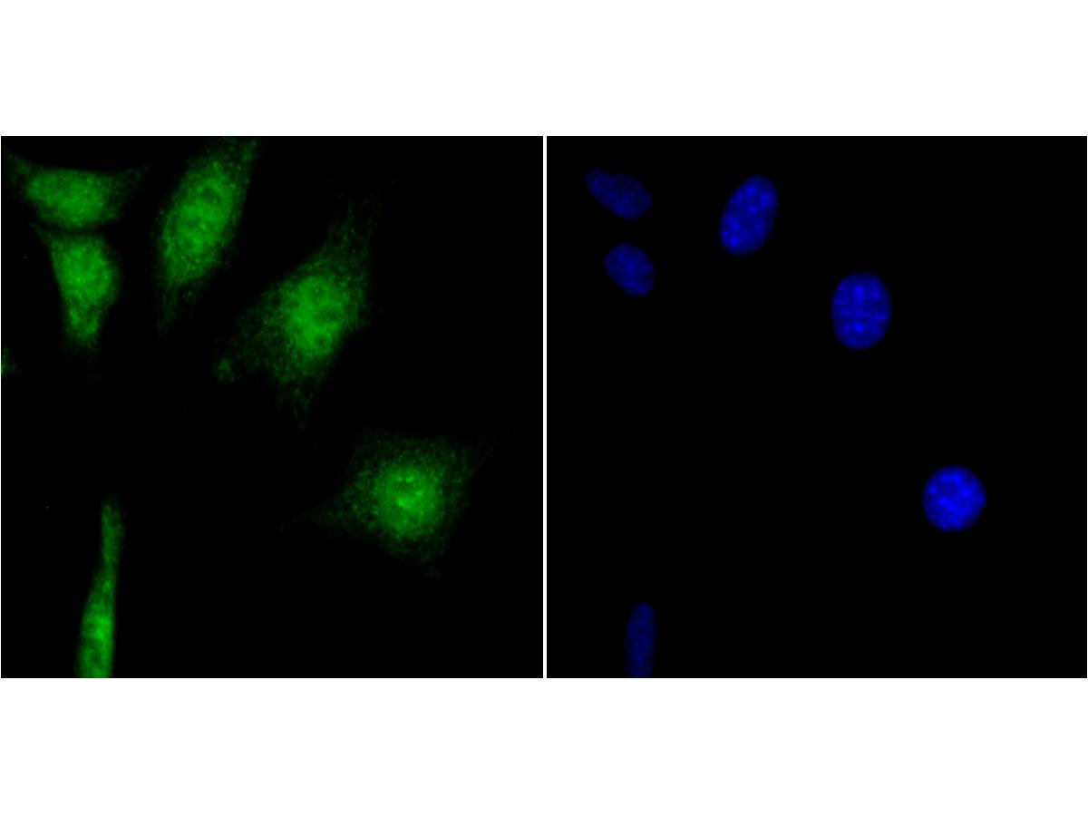 ICC staining of CAMKIV in 293T cells (green). Formalin fixed cells were permeabilized with 0.1% Triton X-100 in TBS for 10 minutes at room temperature and blocked with 1% Blocker BSA for 15 minutes at room temperature. Cells were probed with the primary antibody (ET7107-96, 1/50) for 1 hour at room temperature, washed with PBS. Alexa Fluor®488 Goat anti-Rabbit IgG was used as the secondary antibody at 1/1,000 dilution. The nuclear counter stain is DAPI (blue).
