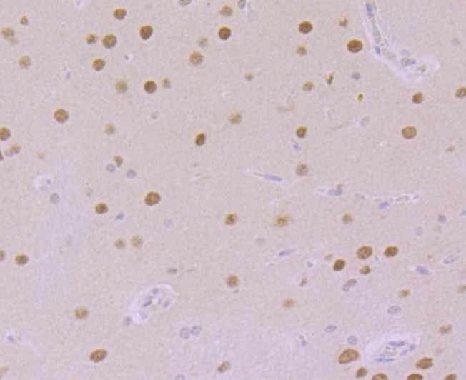 Immunohistochemical analysis of paraffin-embedded rat cerebellum tissue using anti-CAMKIV antibody. The section was pre-treated using heat mediated antigen retrieval with sodium citrate buffer (pH 6.0) for 20 minutes. The tissues were blocked in 5% BSA for 30 minutes at room temperature, washed with ddH2O and PBS, and then probed with the primary antibody (ET7107-96, 1/100)  for 30 minutes at room temperature. The detection was performed using an HRP conjugated compact polymer system. DAB was used as the chromogen. Tissues were counterstained with hematoxylin and mounted with DPX.
