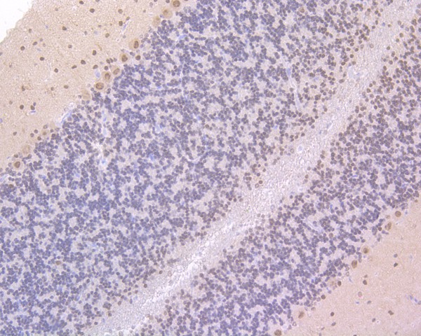 Immunohistochemical analysis of paraffin-embedded mouse brain tissue using anti-CAMKIV antibody. The section was pre-treated using heat mediated antigen retrieval with sodium citrate buffer (pH 6.0) for 20 minutes. The tissues were blocked in 5% BSA for 30 minutes at room temperature, washed with ddH2O and PBS, and then probed with the primary antibody (ET7107-96, 1/200)  for 30 minutes at room temperature. The detection was performed using an HRP conjugated compact polymer system. DAB was used as the chromogen. Tissues were counterstained with hematoxylin and mounted with DPX.