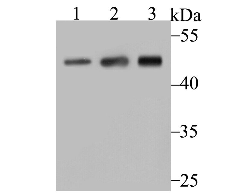 Western blot analysis of Arp3 on different lysates using anti-Arp3 antibody at 1/500 dilution.<br />
 Positive control:<br />
 Lane 1: A431 cell lysate<br />
 Lane 2: Mouse placenta tissue lysate<br />
 Lane 3: Mouse thymus tissue lysate