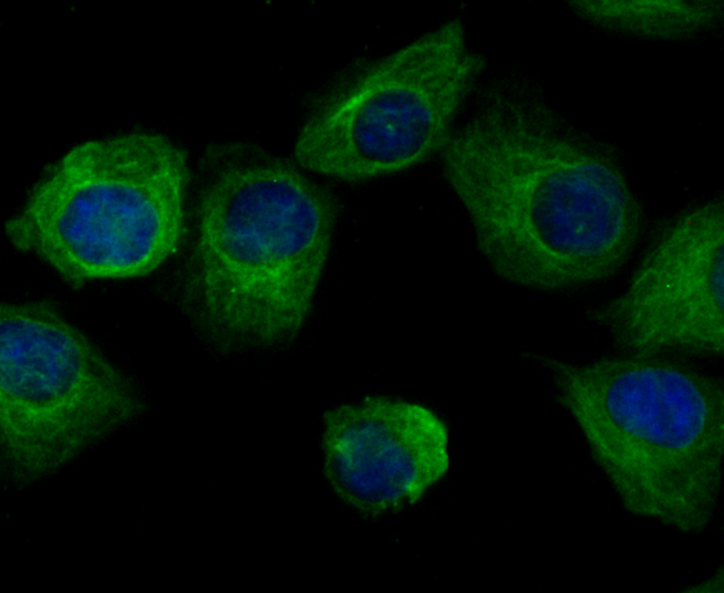 ICC staining Arp3 in HUVEC cells (green). The nuclear counter stain is DAPI (blue). Cells were fixed in paraformaldehyde, permeabilised with 0.25% Triton X100/PBS.