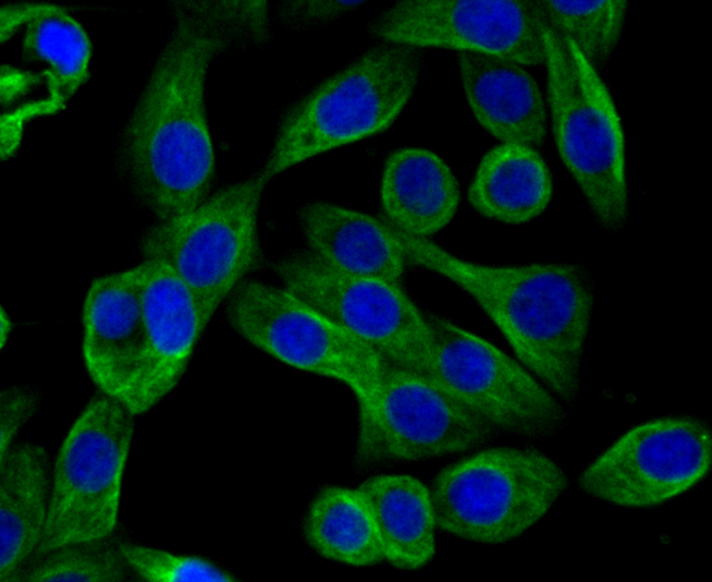 ICC staining Arp3 in LOVO cells (green). The nuclear counter stain is DAPI (blue). Cells were fixed in paraformaldehyde, permeabilised with 0.25% Triton X100/PBS.
