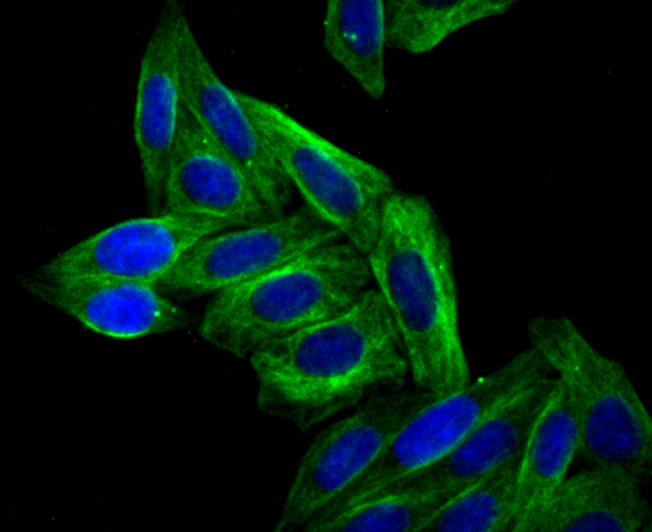 ICC staining Arp3 in SiHa cells (green). The nuclear counter stain is DAPI (blue). Cells were fixed in paraformaldehyde, permeabilised with 0.25% Triton X100/PBS.