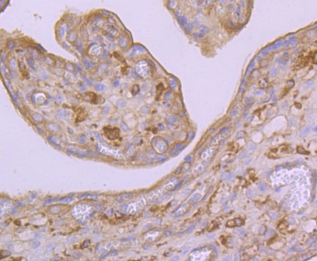 Immunohistochemical analysis of paraffin-embedded human placenta tissue using anti-Arp3 antibody. Counter stained with hematoxylin.