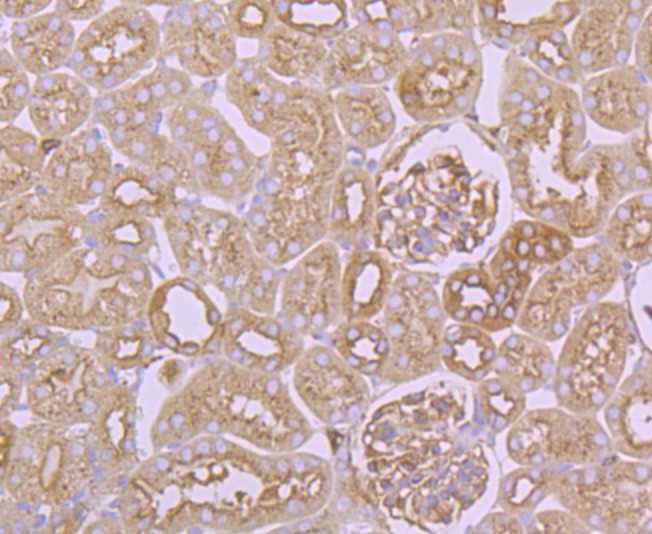 Immunohistochemical analysis of paraffin-embedded mouse kidney tissue using anti-Arp3 antibody. Counter stained with hematoxylin.