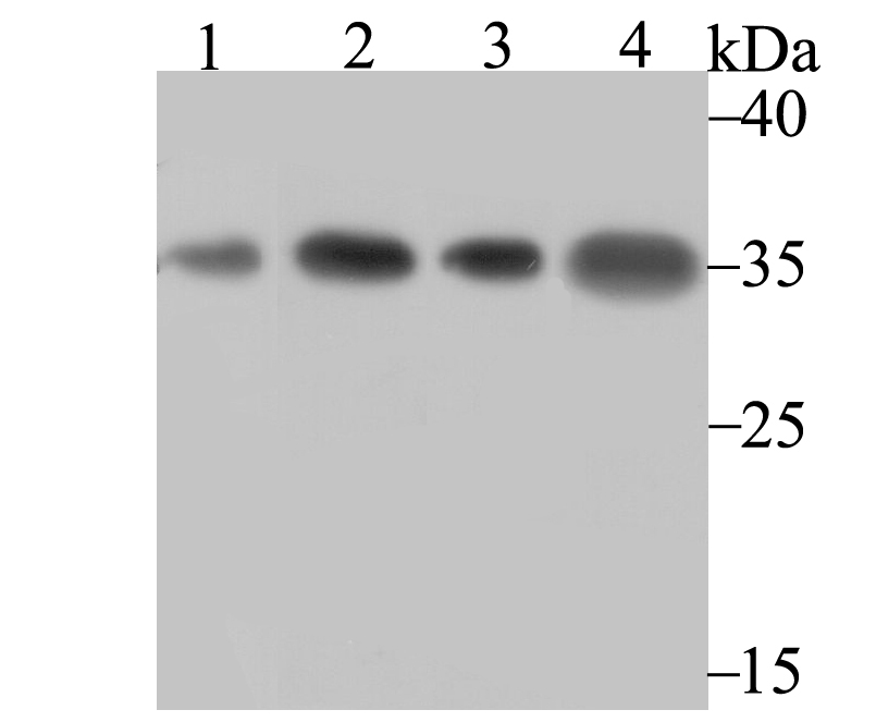 Western blot analysis of U1A on different lysates. Proteins were transferred to a PVDF membrane and blocked with 5% BSA in PBS for 1 hour at room temperature. The primary antibody (ET7107-98, 1/500) was used in 5% BSA at room temperature for 2 hours. Goat Anti-Rabbit IgG - HRP Secondary Antibody (HA1001) at 1:200,000 dilution was used for 1 hour at room temperature.<br />
Positive control: <br />
Lane 1: Rat brain tissue lysate<br />
Lane 2: K562 cell lysate<br />
Lane 3: A431 cell lysate<br />
Lane 4: Mouse kidney tissue lysate
