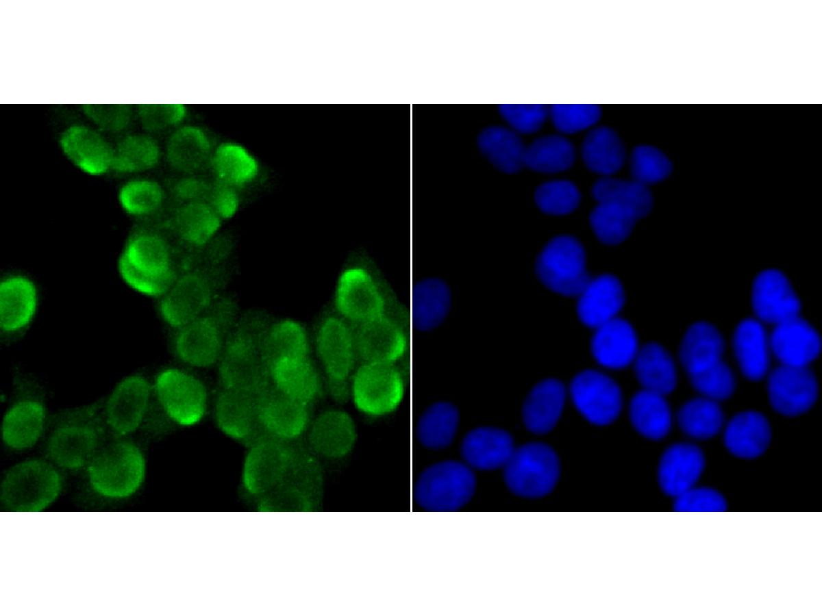 ICC staining of U1A in 293T cells (green). Formalin fixed cells were permeabilized with 0.1% Triton X-100 in TBS for 10 minutes at room temperature and blocked with 10% negative goat serum for 15 minutes at room temperature. Cells were probed with the primary antibody (ET7107-98, 1/50) for 1 hour at room temperature, washed with PBS. Alexa Fluor®488 conjugate-Goat anti-Rabbit IgG was used as the secondary antibody at 1/1,000 dilution. The nuclear counter stain is DAPI (blue).