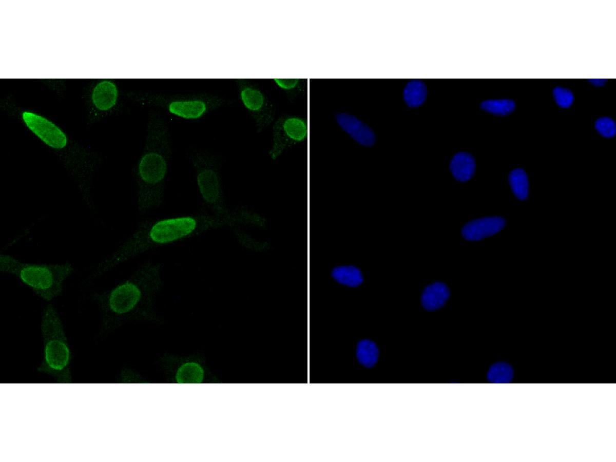 ICC staining of U1A in SH-SY5Y cells (green). Formalin fixed cells were permeabilized with 0.1% Triton X-100 in TBS for 10 minutes at room temperature and blocked with 10% negative goat serum for 15 minutes at room temperature. Cells were probed with the primary antibody (ET7107-98, 1/50) for 1 hour at room temperature, washed with PBS. Alexa Fluor®488 conjugate-Goat anti-Rabbit IgG was used as the secondary antibody at 1/1,000 dilution. The nuclear counter stain is DAPI (blue).