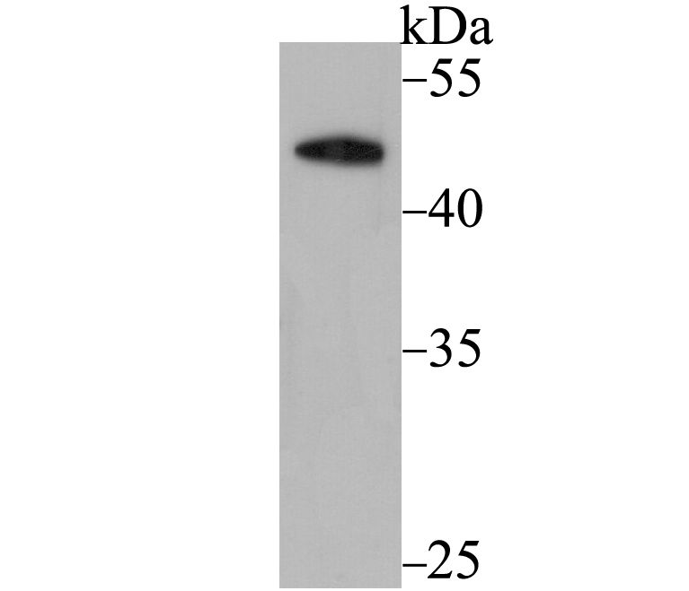 Western blot analysis of DEK on A431 cell lysate using anti-DEK antibody at 1/500 dilution.