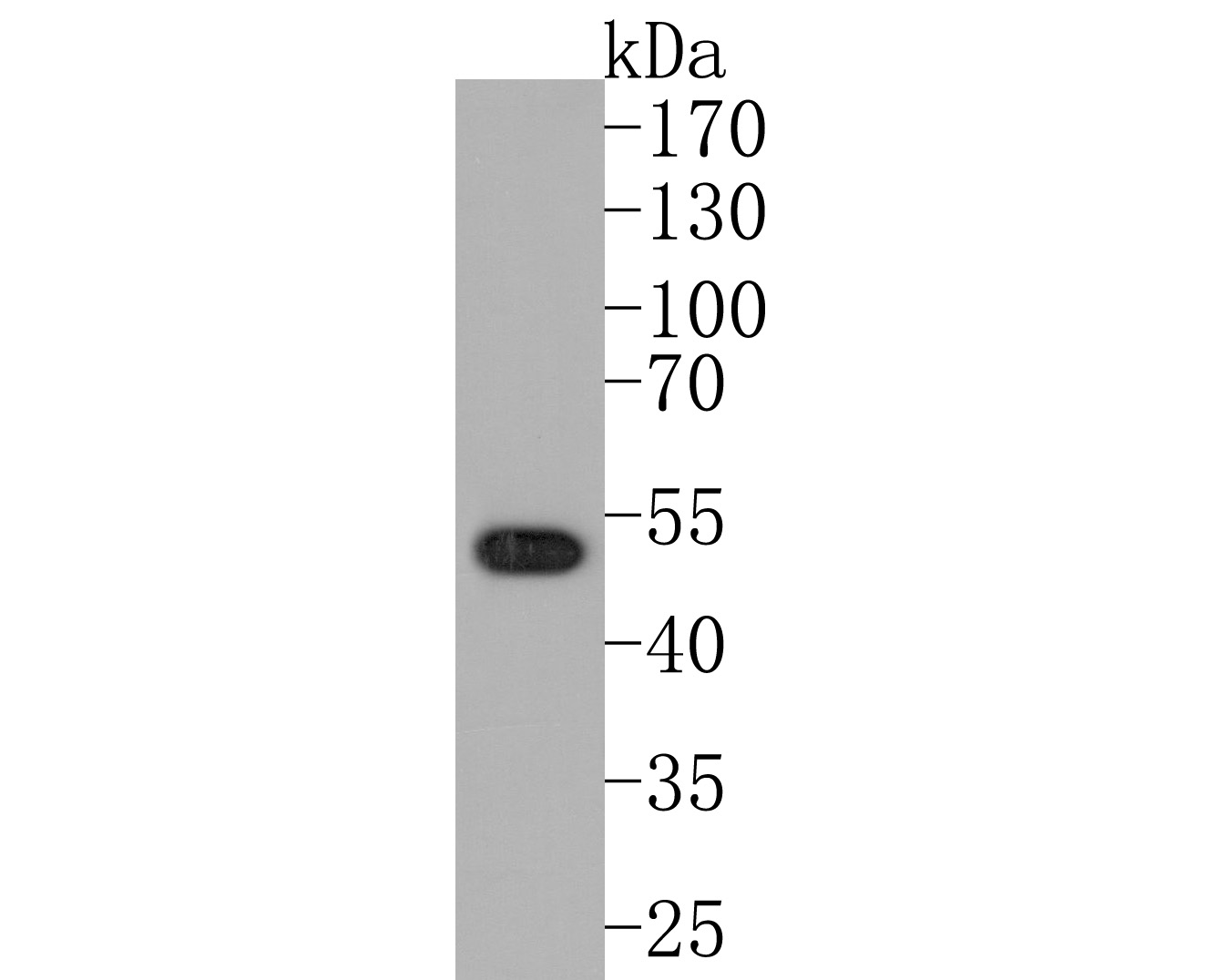 Western blot analysis of CYP26A1 on HepG2 cell lysates. Proteins were transferred to a PVDF membrane and blocked with 5% BSA in PBS for 1 hour at room temperature. The primary antibody (ET7108-02, 1/500) was used in 5% BSA at room temperature for 2 hours. Goat Anti-Rabbit IgG - HRP Secondary Antibody (HA1001) at 1:200,000 dilution was used for 1 hour at room temperature.