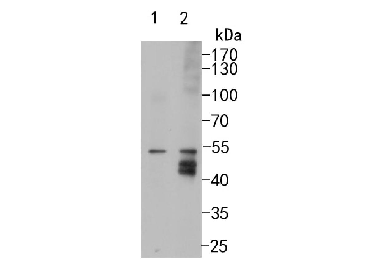 Western blot analysis of CYP26A1 on different lysates. Proteins were transferred to a PVDF membrane and blocked with 5% BSA in PBS for 1 hour at room temperature. The primary antibody (ET7108-02, 1/500) was used in 5% BSA at room temperature for 2 hours. Goat Anti-Rabbit IgG - HRP Secondary Antibody (HA1001) at 1:200,000 dilution was used for 1 hour at room temperature.<br />
Positive control: <br />
Lane 1: 293 cell lysate<br />
Lane 2: Human liver tissue lysate