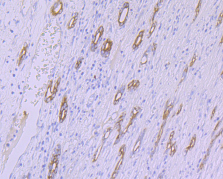 Immunohistochemical analysis of paraffin-embedded human liver tissue using anti-CYP26A1 antibody. The section was pre-treated using heat mediated antigen retrieval with Tris-EDTA buffer (pH 9.0) for 20 minutes.The tissues were blocked in 1% BSA for 30 minutes at room temperature, washed with ddH2O and PBS, and then probed with the primary antibody (ET7108-02, 1/50) for 30 minutes at room temperature. The detection was performed using an HRP conjugated compact polymer system. DAB was used as the chromogen. Tissues were counterstained with hematoxylin and mounted with DPX.
