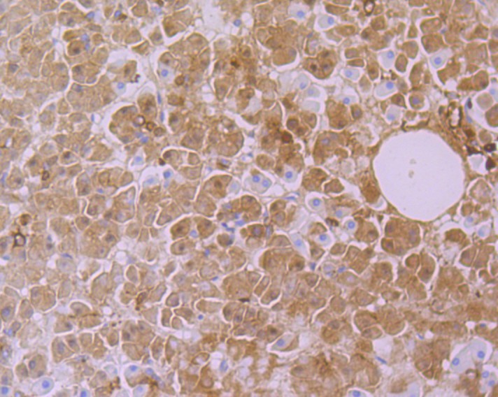 Immunohistochemical analysis of paraffin-embedded human pancreas tissue using anti-CYP26A1 antibody. The section was pre-treated using heat mediated antigen retrieval with Tris-EDTA buffer (pH 9.0) for 20 minutes.The tissues were blocked in 1% BSA for 30 minutes at room temperature, washed with ddH2O and PBS, and then probed with the primary antibody (ET7108-02, 1/50) for 30 minutes at room temperature. The detection was performed using an HRP conjugated compact polymer system. DAB was used as the chromogen. Tissues were counterstained with hematoxylin and mounted with DPX.