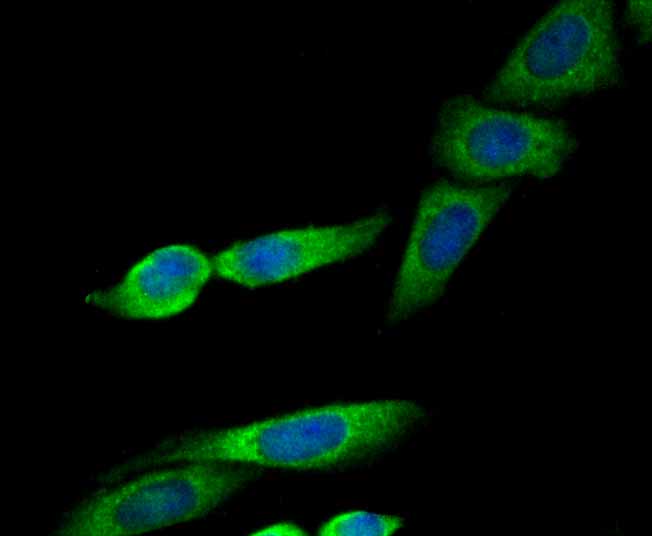 ICC staining ERp29 in SiHa cells (green). The nuclear counter stain is DAPI (blue). Cells were fixed in paraformaldehyde, permeabilised with 0.25% Triton X100/PBS.