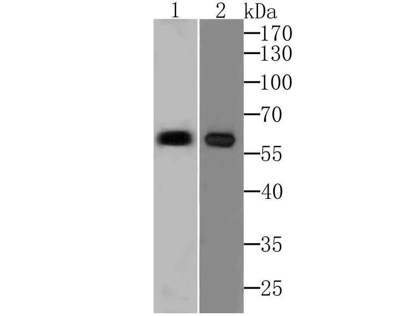 Western blot analysis of PARP2 on SiHa cell lysate and Raji cell lysate using anti-PARP2 at 1/500 dilution.