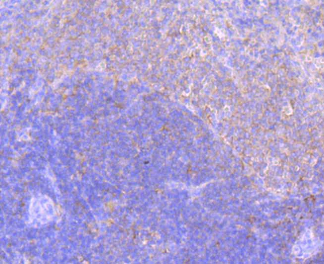 Immunohistochemical analysis of paraffin-embedded rat spleen tissue using anti-ELMO1 antibody. The section was pre-treated using heat mediated antigen retrieval with Tris-EDTA buffer (pH 8.0-8.4) for 20 minutes.The tissues were blocked in 5% BSA for 30 minutes at room temperature, washed with ddH2O and PBS, and then probed with the primary antibody (ET7108-06, 1/50) for 30 minutes at room temperature. The detection was performed using an HRP conjugated compact polymer system. DAB was used as the chromogen. Tissues were counterstained with hematoxylin and mounted with DPX.