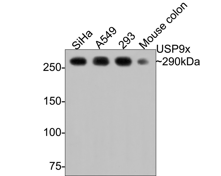Western blot analysis of USP9x on different lysates with Rabbit anti-USP9x antibody (ET7108-08) at 1/500 dilution.<br />
<br />
Lane 1: SiHa cell lysate<br />
Lane 2: A549 cell lysate<br />
Lane 3: 293 cell lysate<br />
Lane 4: Mouse colon tissue lysate (20 µg/Lane)<br />
<br />
Lysates/proteins at 10 µg/Lane.<br />
<br />
Predicted band size: 290 kDa<br />
Observed band size: 290 kDa<br />
<br />
Exposure time: 2 minutes;<br />
<br />
6% SDS-PAGE gel.<br />
<br />
Proteins were transferred to a PVDF membrane and blocked with 5% NFDM/TBST for 1 hour at room temperature. The primary antibody (ET7108-08) at 1/500 dilution was used in 5% NFDM/TBST at room temperature for 2 hours. Goat Anti-Rabbit IgG - HRP Secondary Antibody (HA1001) at 1:300,000 dilution was used for 1 hour at room temperature.