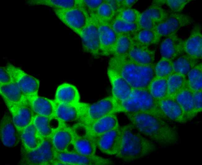 ICC staining of USP9x in F9 cells (green). Formalin fixed cells were permeabilized with 0.1% Triton X-100 in TBS for 10 minutes at room temperature and blocked with 1% Blocker BSA for 15 minutes at room temperature. Cells were probed with the primary antibody (ET7108-08, 1/50) for 1 hour at room temperature, washed with PBS. Alexa Fluor®488 Goat anti-Rabbit IgG was used as the secondary antibody at 1/1,000 dilution. The nuclear counter stain is DAPI (blue).