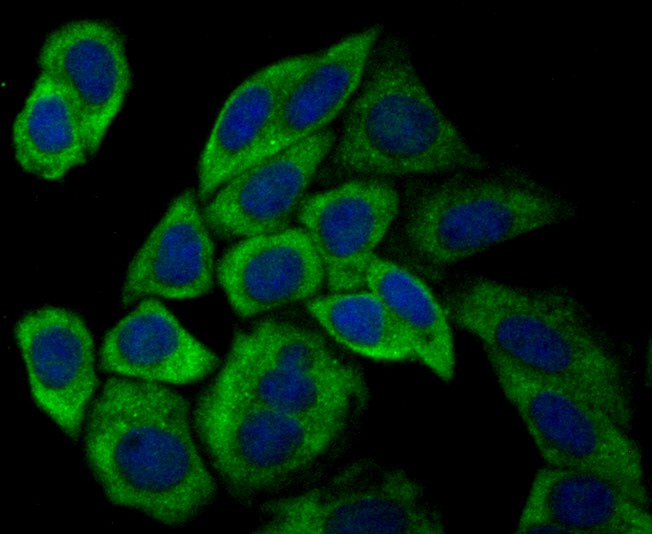ICC staining of USP9x in SiHa cells (green). Formalin fixed cells were permeabilized with 0.1% Triton X-100 in TBS for 10 minutes at room temperature and blocked with 1% Blocker BSA for 15 minutes at room temperature. Cells were probed with the primary antibody (ET7108-08, 1/50) for 1 hour at room temperature, washed with PBS. Alexa Fluor®488 Goat anti-Rabbit IgG was used as the secondary antibody at 1/1,000 dilution. The nuclear counter stain is DAPI (blue).
