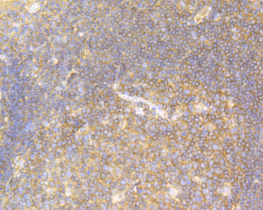 Immunohistochemical analysis of paraffin-embedded human tonsil tissue using anti-USP9x antibody. The section was pre-treated using heat mediated antigen retrieval with Tris-EDTA buffer (pH 8.0-8.4) for 20 minutes.The tissues were blocked in 5% BSA for 30 minutes at room temperature, washed with ddH2O and PBS, and then probed with the primary antibody (ET7108-08, 1/50) for 30 minutes at room temperature. The detection was performed using an HRP conjugated compact polymer system. DAB was used as the chromogen. Tissues were counterstained with hematoxylin and mounted with DPX.
