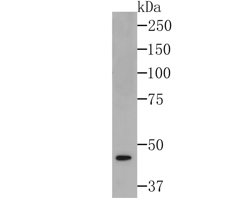 Western blot analysis of eIF4A3 on SiHa cell lysates using anti-eIF4A3 at 1/500 dilution.